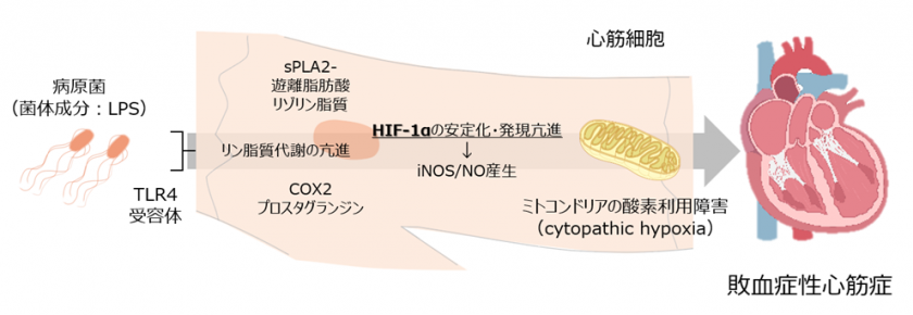 敗血症性心筋症が生じる仕組みを解明・治療開発に向けた基盤を構築